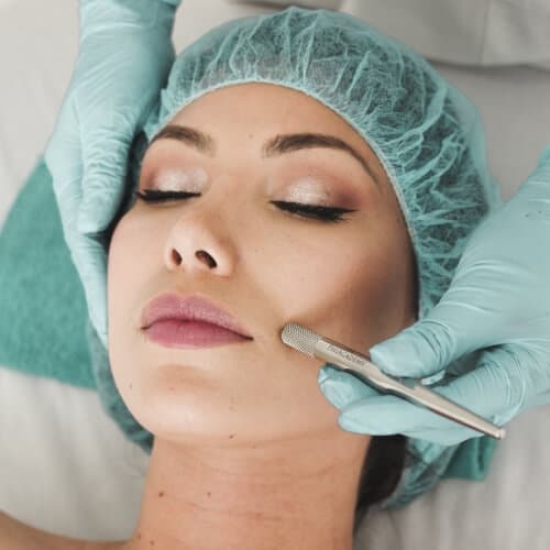 PRP Facial